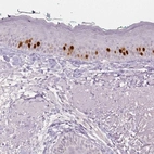 Immunohistochemical staining of human skin shows moderate to strong nuclear positivity in a subset of dermal cells.