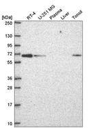 Western blot analysis in human cell line RT-4, human cell line U-251 MG, human plasma, human liver tissue and human tonsil tissue.