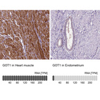 Anti-GOT1 Antibody