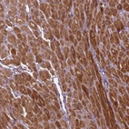 Immunohistochemical staining of human heart muscle shows strong cytoplasmic positivity in cardiomyocytes.