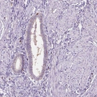Immunohistochemical staining of human endometrium shows negative cytoplasmic positivity in glandular cells as expected.