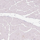 Immunohistochemical staining of human skeletal muscle shows no nuclear positivity in striated muscle fibers as expected.