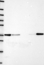 Lane 1: Marker [kDa] 250, 130, 95, 72, 55, 36, 28, 17, 10 | Lane 2: RT4 | Lane 3: U-251 MG | Lane 4: Human Plasma | Lane 5: Liver | Lane 6: Tonsil
