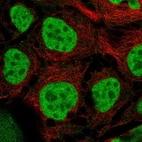 Immunofluorescent staining of human cell line CACO-2 shows localization to nucleoplasm.