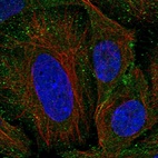 Anti-SEM1 Antibody