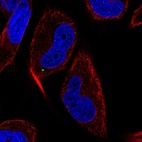 Anti-MAP1LC3C Antibody