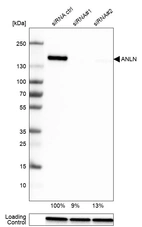 Western blot analysis in U-251MG cells transfected with control siRNA, target specific siRNA probe #1 and #2, using Anti-ANLN antibody. Remaining relative intensity is presented. Loading control: Anti-GAPDH.