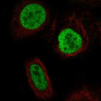 Anti-YTHDC2 Antibody