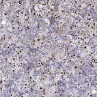 Anti-TBX19 Antibody