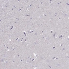 Immunohistochemical staining of human cerebral cortex shows no nuclear positivity in neurons as expected.