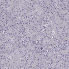 Anti-TBX19 Antibody