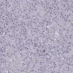 Immunohistochemical staining of human pancreas shows no nuclear positivity in exocrine glandular cells as expected.