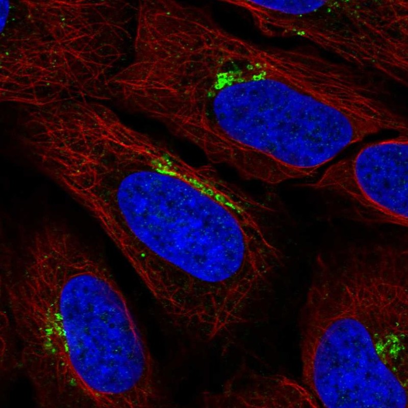 Anti-KIAA0319L Antibody