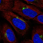 Anti-KIAA0319L Antibody