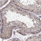 Anti-CMTM3 Antibody