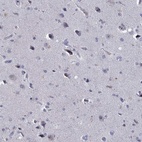 Immunohistochemical staining of human cerebral cortex shows low expression as expected.