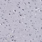 Immunohistochemical staining of human cerebral cortex shows low expression as expected.