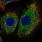 Immunofluorescent staining of human cell line HaCaT shows localization to nuclear membrane & endoplasmic reticulum.