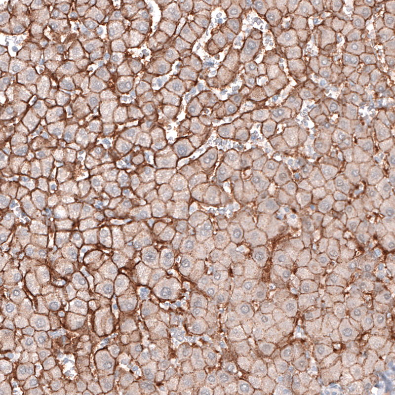 Anti-SLC16A2 Antibody