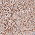 Anti-SLC16A2 Antibody