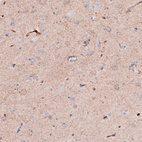 Immunohistochemical staining of human cerebral cortex shows moderate positivity in neuropil.