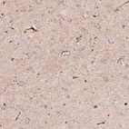 Immunohistochemical staining of human cerebral cortex shows moderate positivity in neuropil.