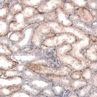 Immunohistochemical staining of human kidney shows moderate membranous positivity in cells in tubules.