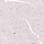 Immunohistochemical staining of human skeletal muscle shows no positivity in striated muscle fibers as expected.