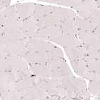 Immunohistochemical staining of human skeletal muscle shows no positivity in striated muscle fibers as expected.
