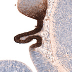 Immunohistochemical staining of mouse embryo E11 shows strong membranous positivity in the developing circumventricular organ.