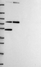Anti-MTA2 Antibody