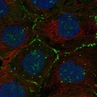 Anti-FBLIM1 Antibody
