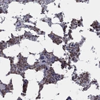 Anti-PSTPIP1 Antibody