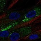 Immunofluorescent staining of human cell line ASC TERT1 shows localization to the Golgi apparatus.
