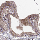 Anti-ABL2 Antibody