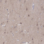 Immunohistochemical staining of human cerebral cortex shows weak cytoplasmic positivity in neurons and neuropil.