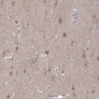 Anti-ABL2 Antibody