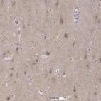 Immunohistochemical staining of human cerebral cortex shows weak cytoplasmic positivity in neurons and neuropil.