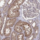 Immunohistochemical staining of human kidney shows moderate cytoplasmic positivity in cells in tubules.