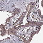 Anti-ABL2 Antibody