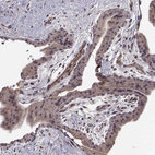 Immunohistochemical staining of human placenta shows weak cytoplasmic positivity in trophoblastic cells.