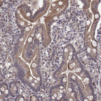 Anti-ABL2 Antibody