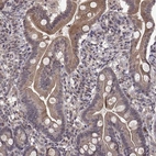 Immunohistochemical staining of human gastrointestinal shows moderate cytoplasmic positivity in glandular cells.