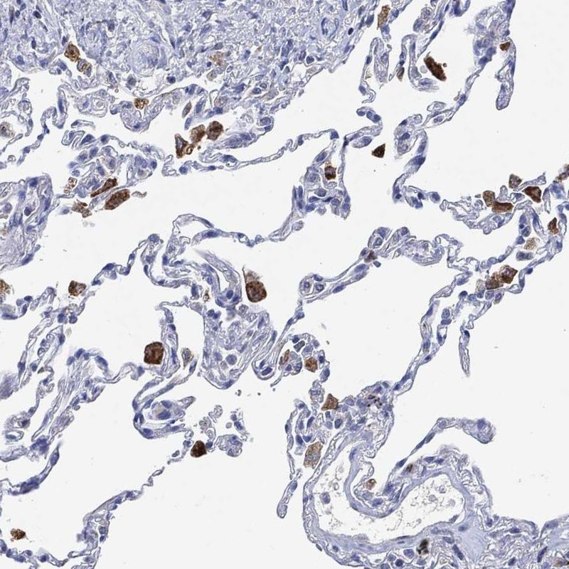 Anti-VSIG4 Antibody