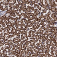 Anti-ALDH4A1 Antibody