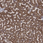 Anti-ALDH4A1 Antibody