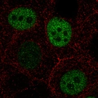 Immunofluorescence staining in MCF7 cell line with Anti-ANLN monoclonal antibody, showing cell cycle dependent nuclear (without nucleoli) staining in green. Microtubule- and nuclear probes are visualized in red and blue respectively (where available).