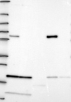 Anti-ALDH4A1 Antibody