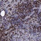 Immunohistochemical staining of human lymph node shows high expression.