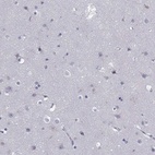 Immunohistochemical staining of human cerebral cortex shows low expression as expected.